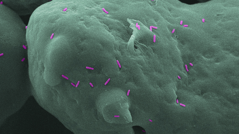 Anti-bacterial 3D printed parts to help limit infections