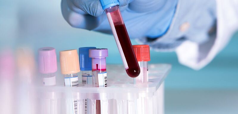 Oxford Univ.  introduces new blood test identifying cancer